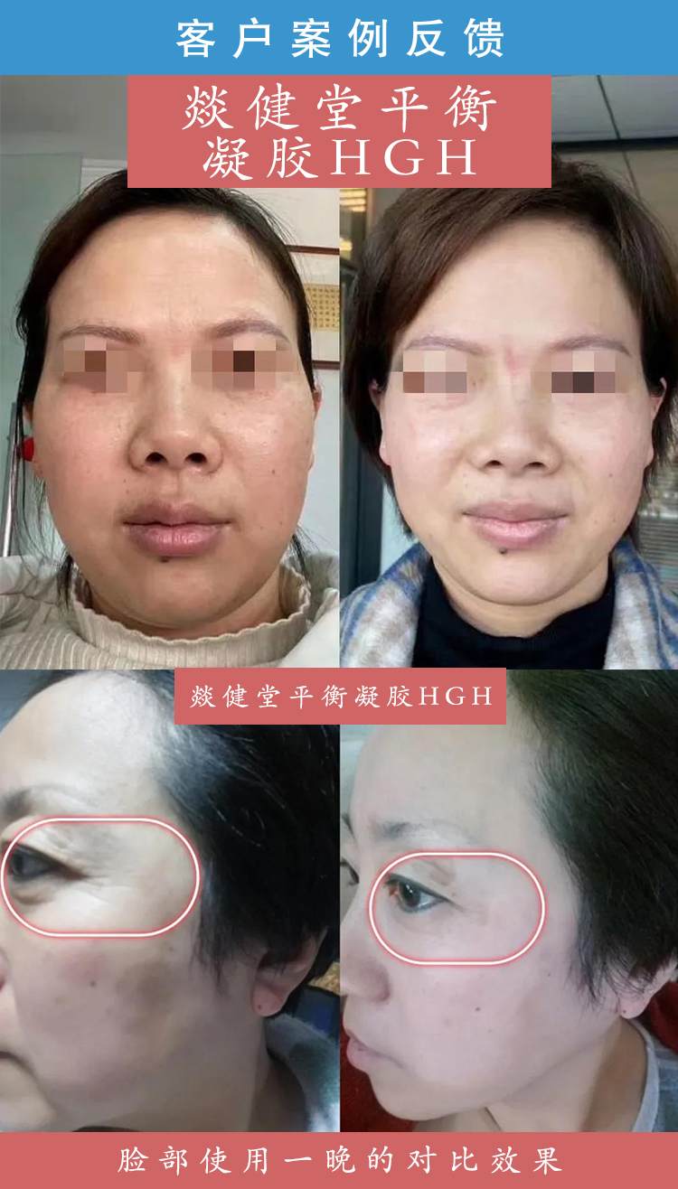 HGH凝胶详情页_22.jpg