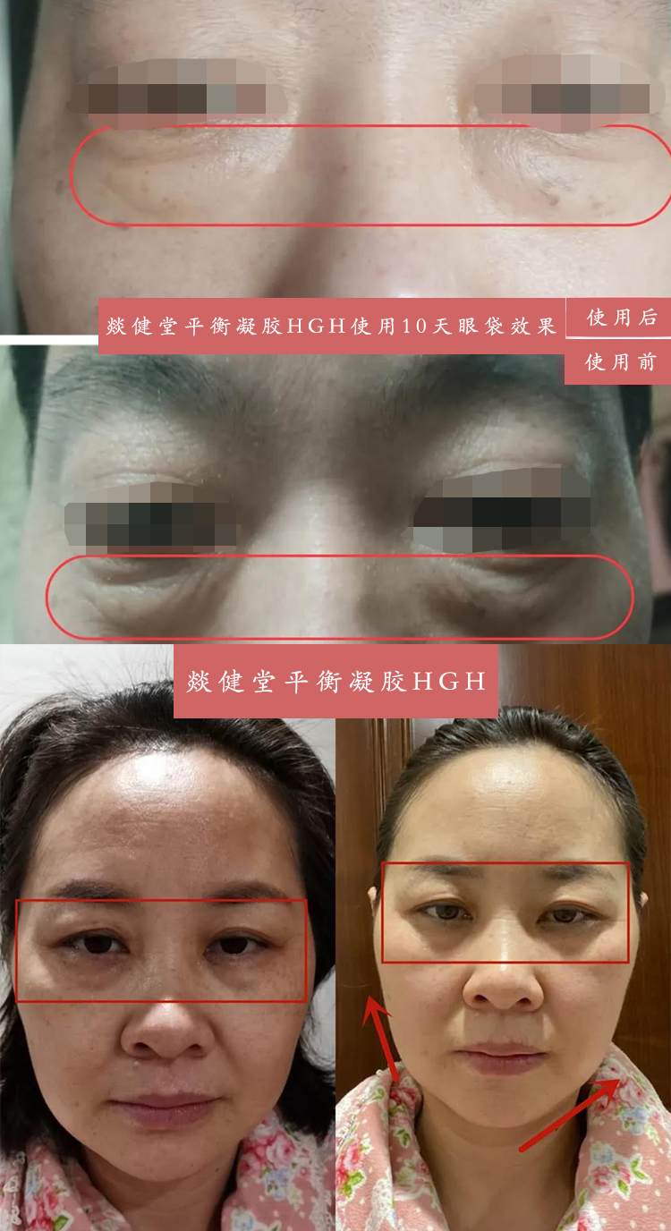 HGH凝胶详情页_23.jpg